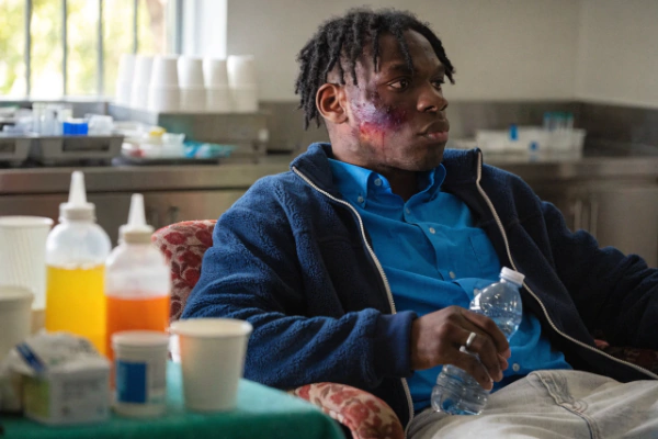 Burn Injury Compensation Claims